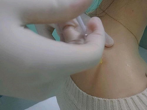 女子肩胛骨灵活到能夹死苍蝇