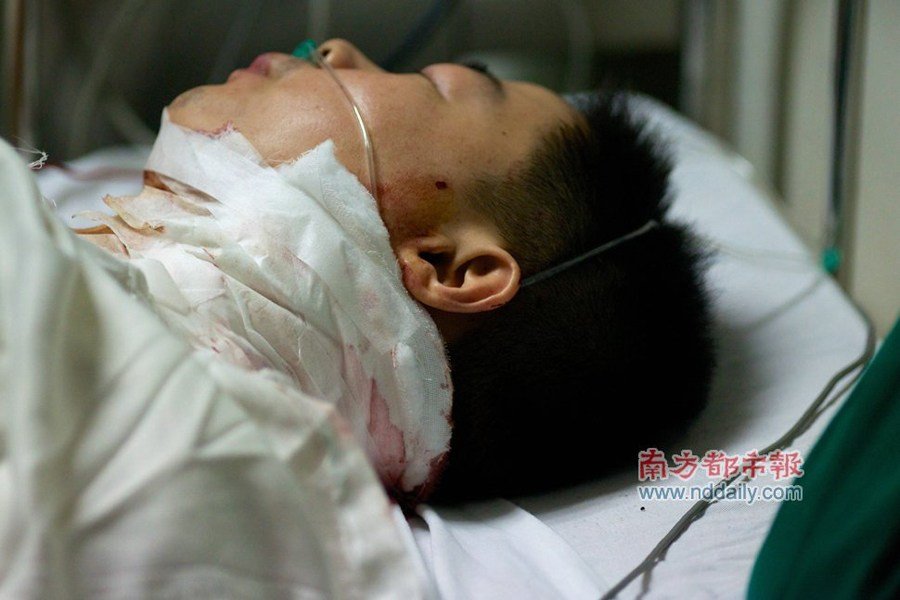 中千万父亲砍伤前妻