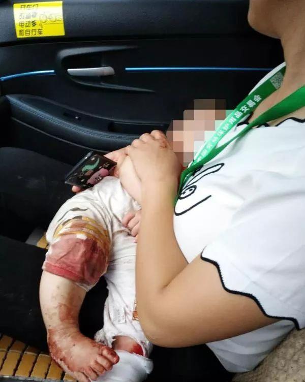 揪心！3岁宝宝浑身伤却更担心遇车祸的妈妈，背后真相令人泪目
